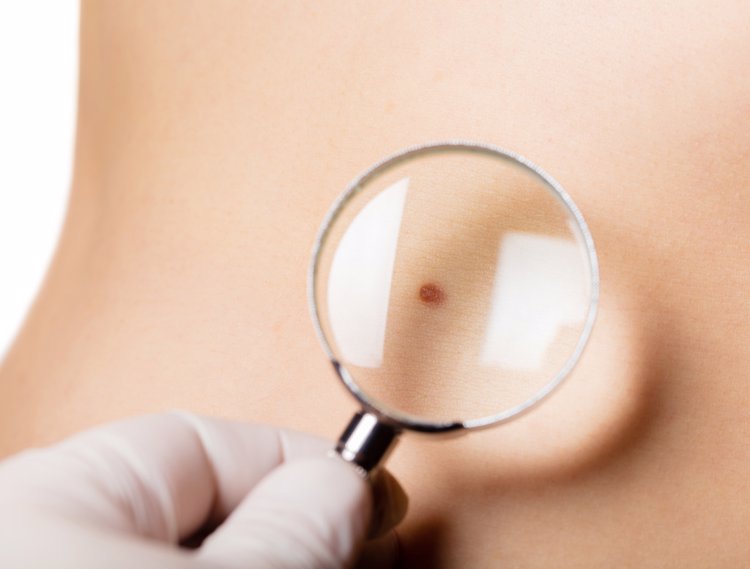 脖子上長了好多肉感_脖子上長了好多肉粒什么原因_脖子上長了好多肉就怎么辦